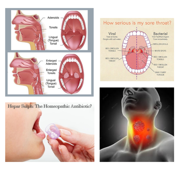 Feelgood Throat & Tonsil Dr - Homeopathic remedy for tonsillitis & sore throats